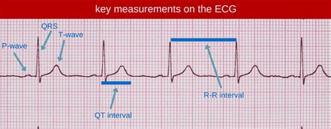 Why the QT Interval Matters - Straight A Nursing