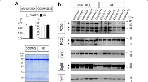 Western blot analysis of secretory proteins in the CSF of AD patients ...