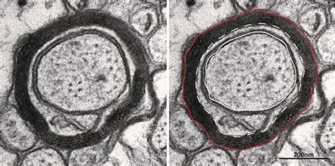 Myelinated axon measurements. Left: close-up image view of myelinated ...