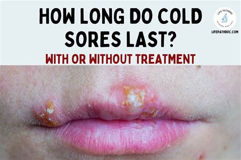 How Long Do Cold Sores Last?