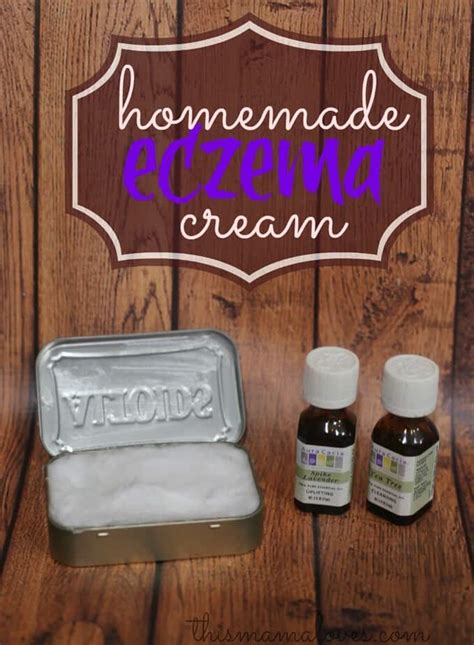 Homemade Eczema Cream Recipe - This Mama Loves