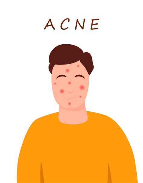 Cartoon teenage character with acne skin. Skin problems concept ...