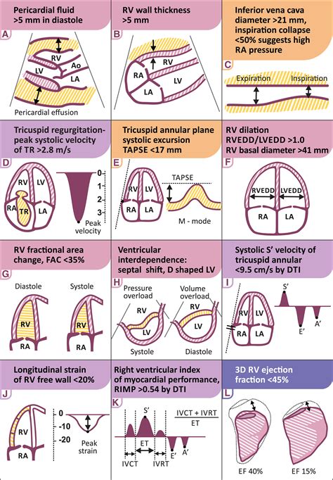 Echocardiogram Of Heart Failure