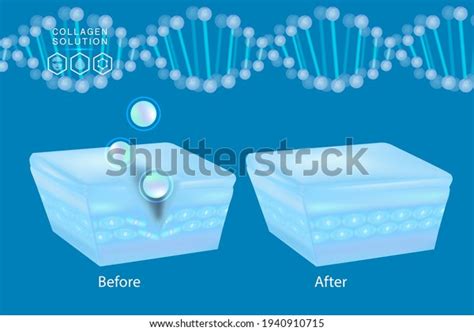 Hyaluronic Acid Before After Skin Solutions Stock Vector (Royalty Free) 1940910715 | Shutterstock