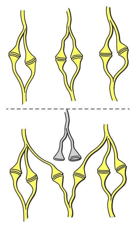 Mechanisms of neuroplasticity. Illustrated in panels (a)–(d) are the ...