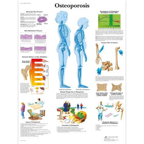 Obraz Osteoporóza 50x67cm