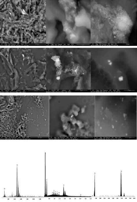 - Electron microscope immages of NPs in earthworms tissues. In... | Download Scientific Diagram