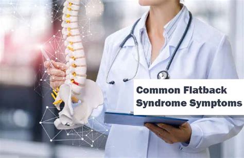 Common Flatback Syndrome Symptoms | Treating Scoliosis