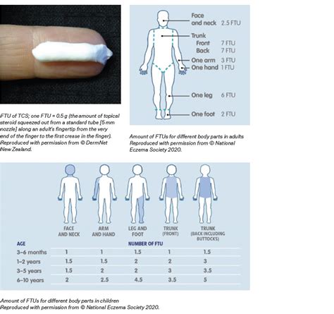 RACGP - Selection of an effective topical corticosteroid