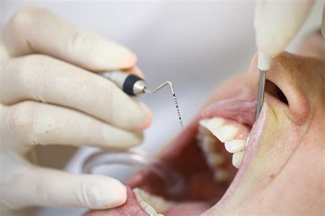 Periodontal Disease Treatment