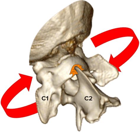 Canine Atlantoaxial Instability - NDSR