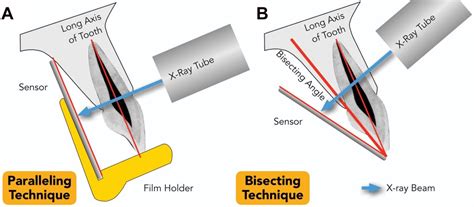 Radiology in Endodontics | Pocket Dentistry