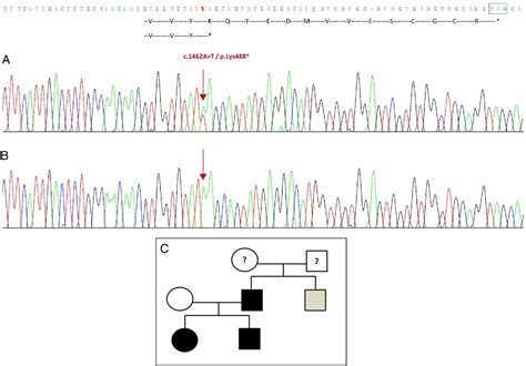 Figure 2 from Brachydactyly type C due to a nonsense mutation in the ...