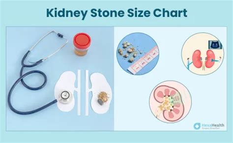 What is Kidney Stone Size Chart in MM and Treatment?