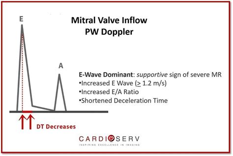 Mitral Valve PW Inflow | Medical knowledge, Echocardiogram, Cardiac sonography