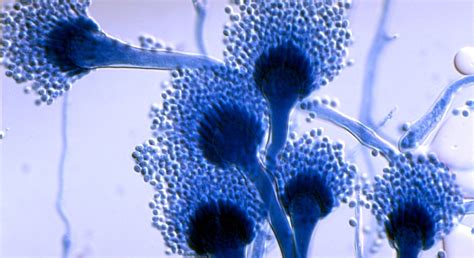 Aspergillus Microscope