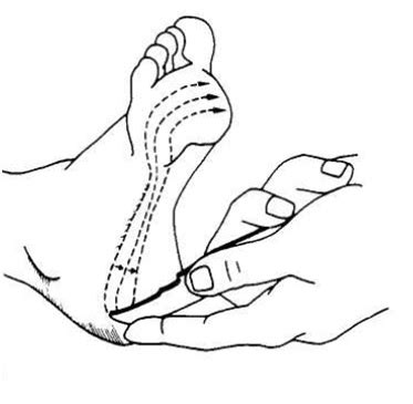 Plantar Response - Physiopedia