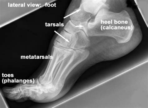 Medical School • X-ray of a normal adult foot (lateral view)