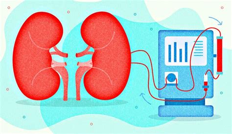 Kidney Dialysis: Types, Cost, Doctors, Hospitals & Best Dialysis Center in Ghaziabad or Delhi ...