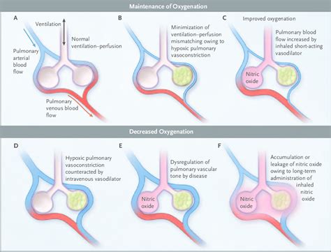 Mechanism of Action and Inaction of Inhaled Nitric Oxide. | Download Scientific Diagram