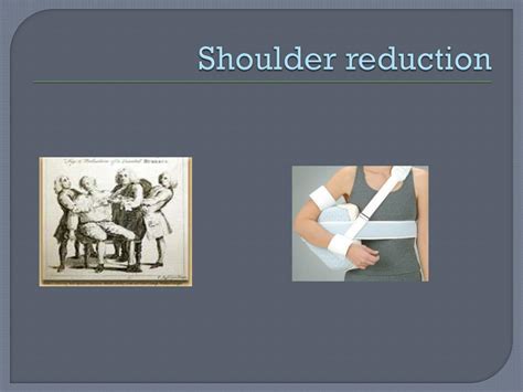 PPT - Shoulder Anatomy PowerPoint Presentation, free download - ID:2038249