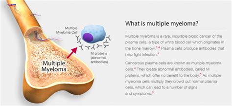 The above figure is from Myeloma Explained Resource (1) below