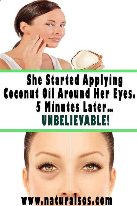 She Started Applying Coconut Oil Around Her Eyes. in 2020 | Apply ...