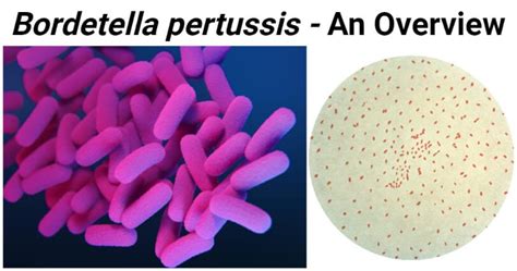 Bordetella pertussis- An Overview - Microbe Notes