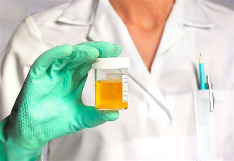 Dark Urine: Symptoms, Causes, and Treatment