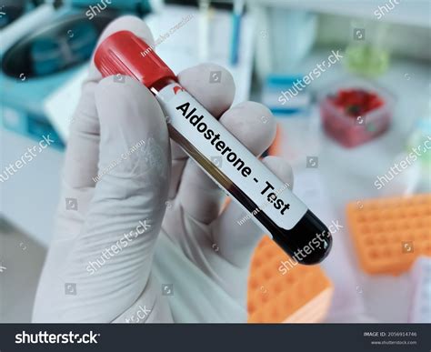 Blood Sample Aldosterone Hormone Test Medical Stock Photo 2056914746 ...