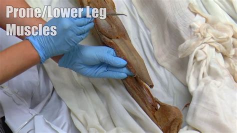 Cadaver Leg Muscles Labeled