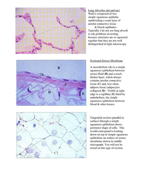 Histology Practice - Micrographs - Lung Alveolus (air end sac) Wall is ...