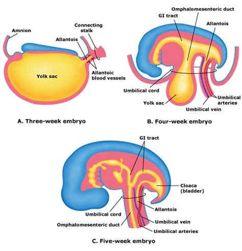 Omphalomesenteric Duct Remnants