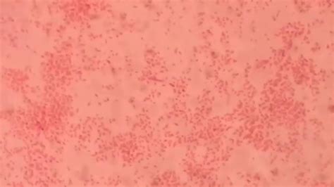 Haemophilus Gram Stain