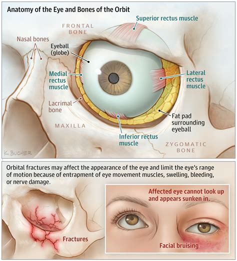 Injury Around the Eye. | Emergency Medicine | JAMA | JAMA Network