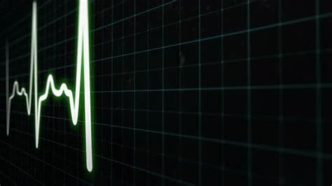 Heart Rate Monitor Electrocardiogram Medical Monitor by mrstef | VideoHive