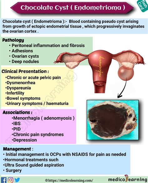 Chocolate Cyst (Ovarian Endometrioma ) – MedicoLearning