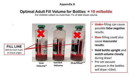 Blood Culture Test Procedure Microbiology, 53% OFF