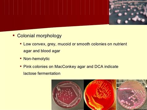 Proteus mirabilis colony morphology - onthegores