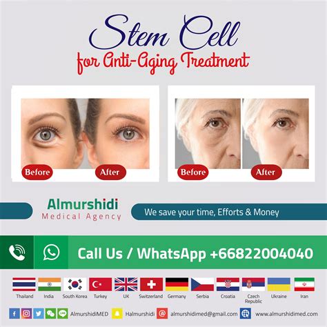 Best Anti Aging Stem Cell Therapy Package Price - Almurshidi Medical Tourism - Best Affordable ...