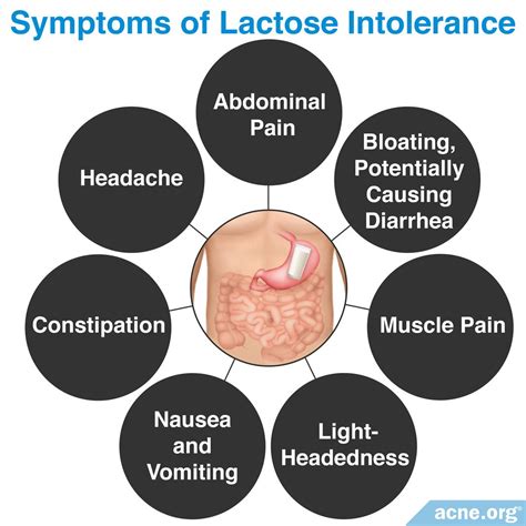 Does Lactose Intolerance Relate to Acne? - Acne.org