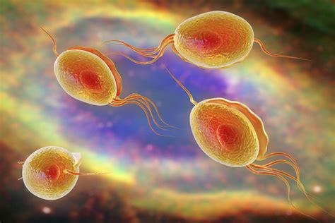 Trichomonas Vaginitis Discharge