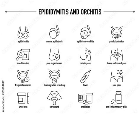 Epididymitis and Orchitis, symptoms, diagnostic and treatment vector ...