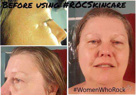 #Sponsored #AD My before face before using ROC Retinol Correxion Eye Cream & ROC Multi Correion ...