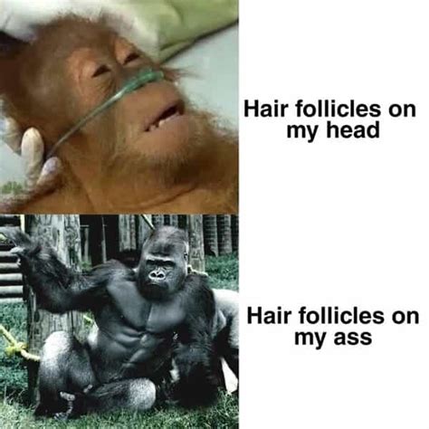 25 Bald Memes for All the People That Are Follicularly Challenged