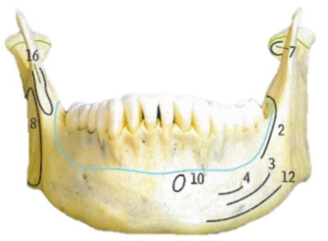 Anterior view of mandible - muscles Diagram | Quizlet