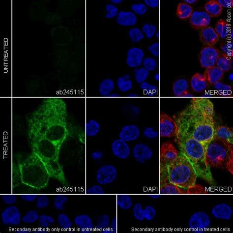 Dendritic Cell Marker