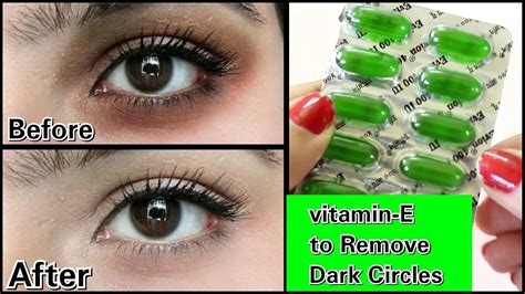 Glycerin And Vitamin E For Dark Circles