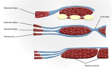 RCSI - Drawing Rectus sheath above and below arcuate line - English labels | AnatomyTOOL