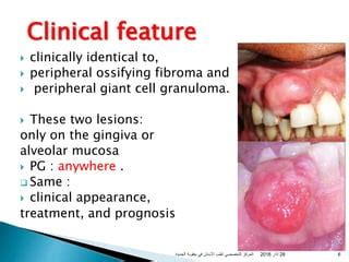 Pyogenic Granuloma In Pregnant Women